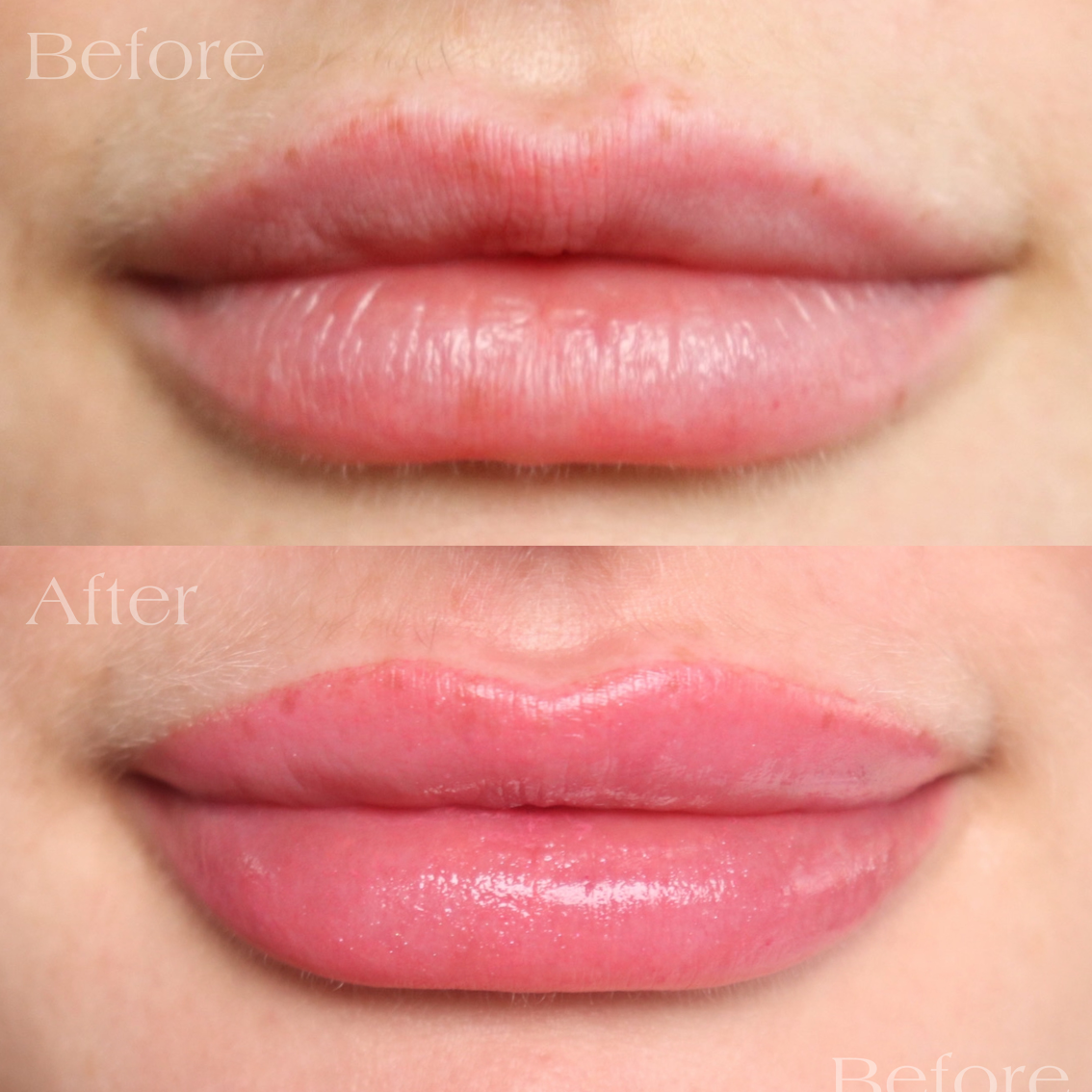Lip Blushing Montreal Before After Aftercare